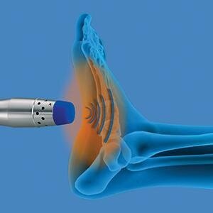 Shockwave therapy for pain