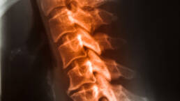 X ray film cervical spine