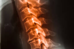 X ray film cervical spine
