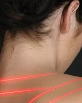 Denver laser therapy for pain used on woman's neck