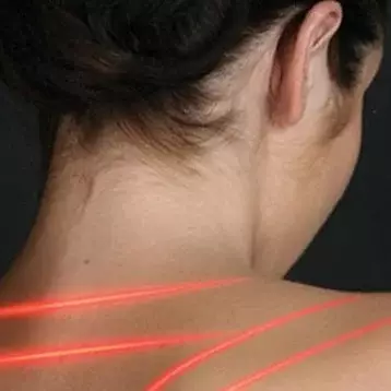 Denver laser therapy for pain used on woman's neck