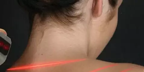 Denver laser therapy for pain used on woman's neck